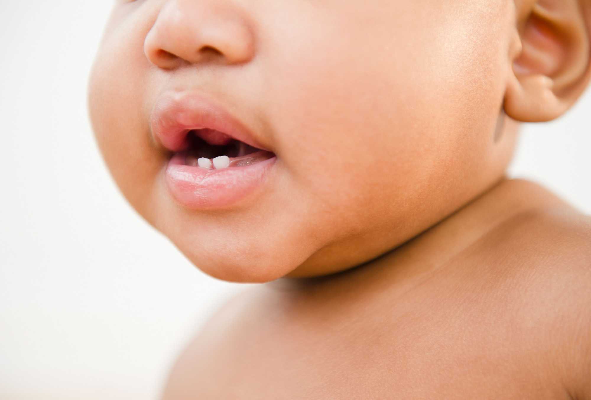 Dentizione: come alleviare il dolore del tuo bambino