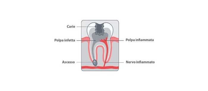 dolore ai denti